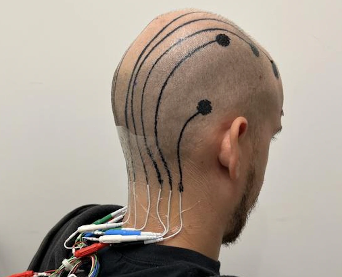 Nuovi E-Tatuaggi per Sostituire i Tradizionali Sistemi EEG